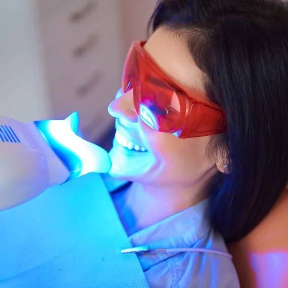 teeth whitening in London